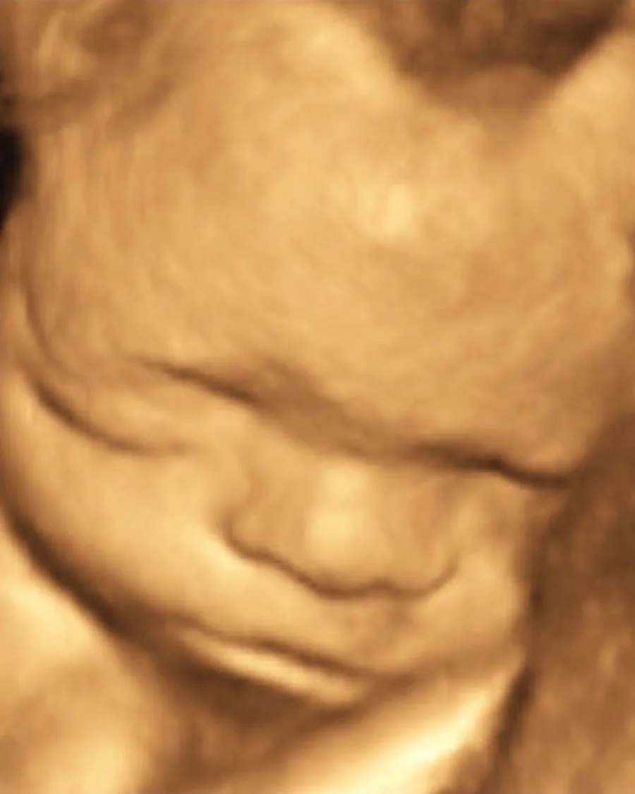 The original 3D ultrasound scan