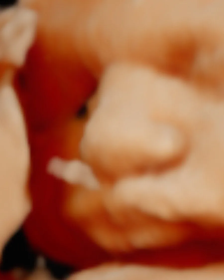 3D ultrasound scan